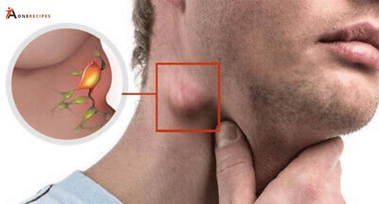 Do you have a lump in your neck, back or behind your ear?