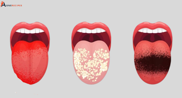 What does your tongue say about your health?