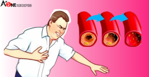 Read more about the article Here are 8 warning signs that you may have clogged arteries