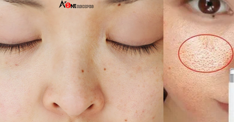 What Those Red Dots on Your Skin Might Be Telling You