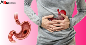 Read more about the article The Silent Killer: Don’t Miss These Signs That You Have Stomach Cancer