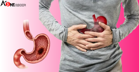 The Silent Killer: Don’t Miss These Signs That You Have Stomach Cancer