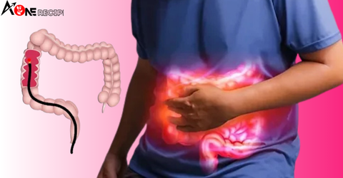 10 Warning Signs colon cancer Never Ignore